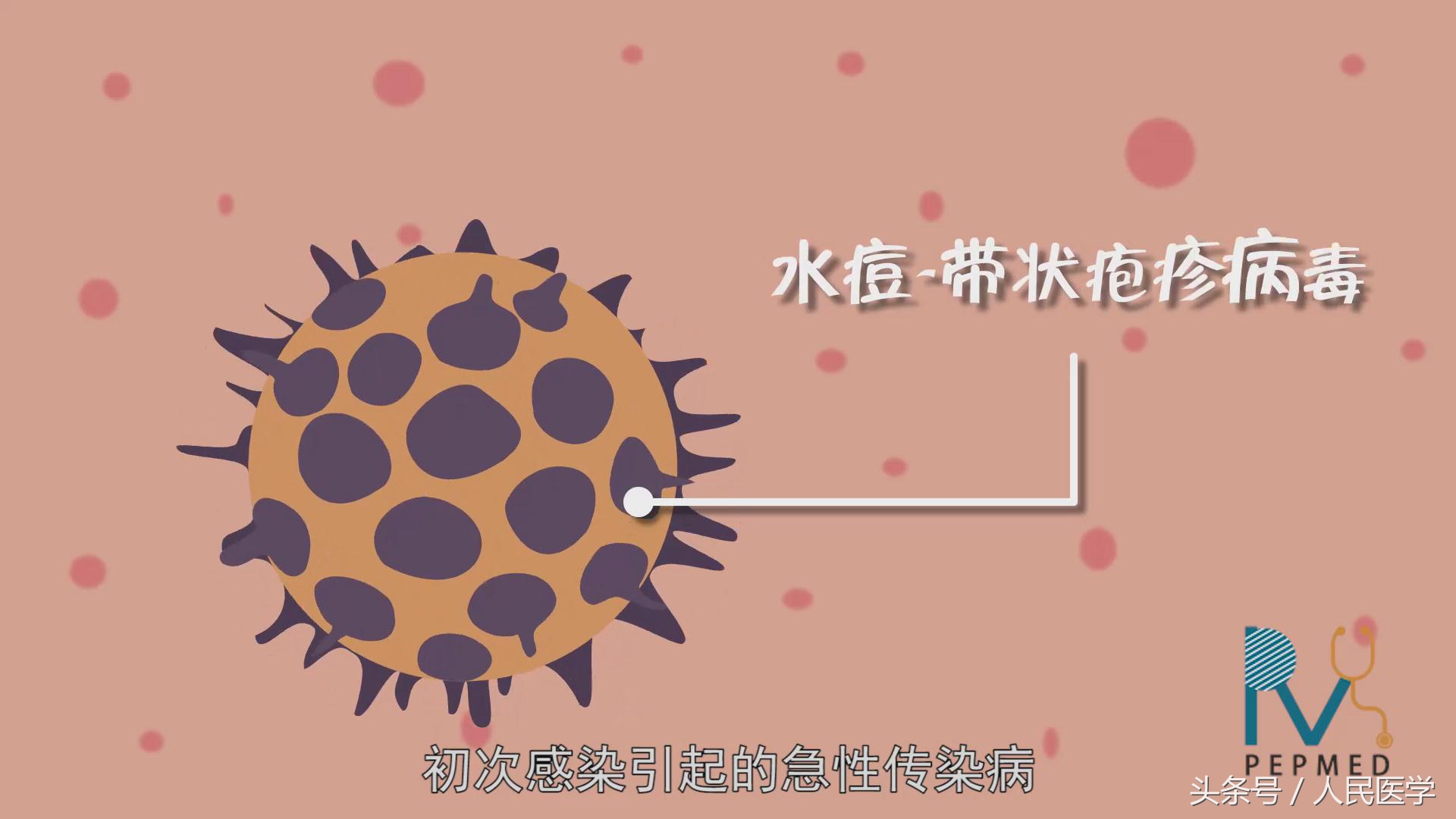 发现学校有孩子得水痘该怎么办,学校出现几例水痘传染病需要停课