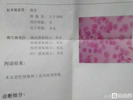 一直没怀过孕查出多囊,输卵管不通多囊月经不调怎么办