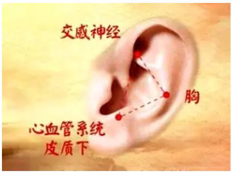 耳穴压豆治疗冠心病贴哪些穴位,冠心病如何通过2个穴位自救