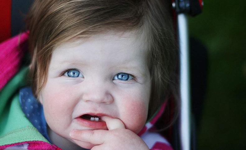 宝宝秋冬脸起皮有何妙招,冬季宝宝苹果脸用什么