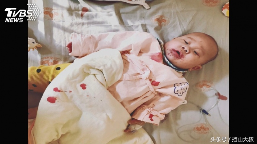 不要亲宝宝脸和嘴,不要亲婴儿