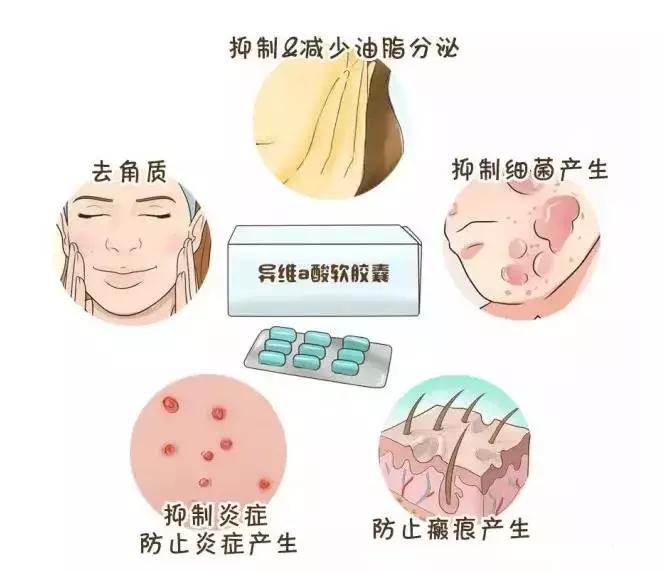 维胺酯和泰尔丝哪个副作用大,泰尔丝副作用真的可怕