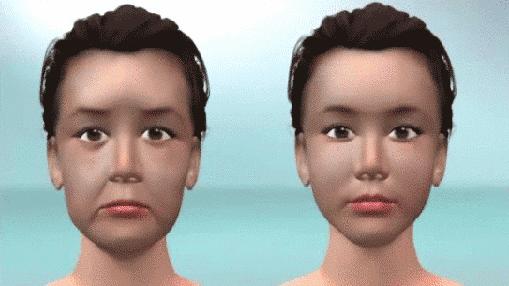 「福利」除皱方法大盘点，总有一种适合你