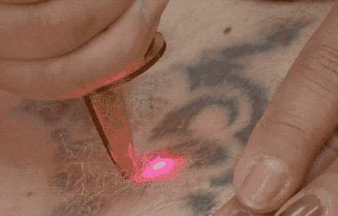 纹身的也是你，洗纹身的也是你！这些动图看完，我都替你疼……