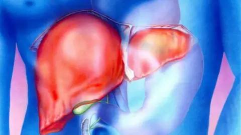 孕妇脂肪肝一般好久可以出院,孕妇脂肪肝吃什么食物好呢