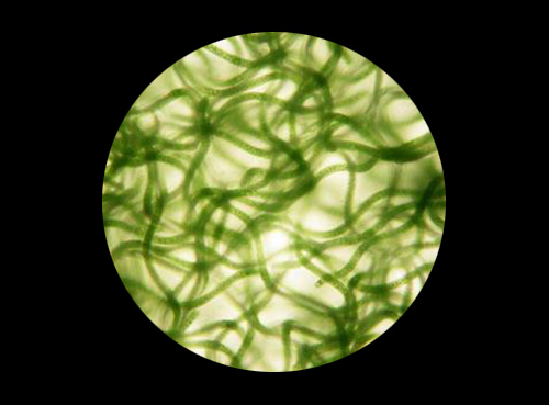 免疫力低下的人吃什么提高免疫力,中年人免疫力低下容易感冒怎么办