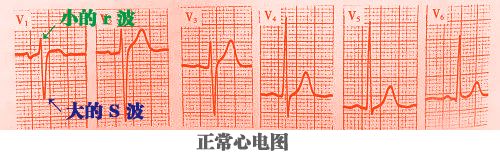 心电图秒懂,心电图零基础都秒懂