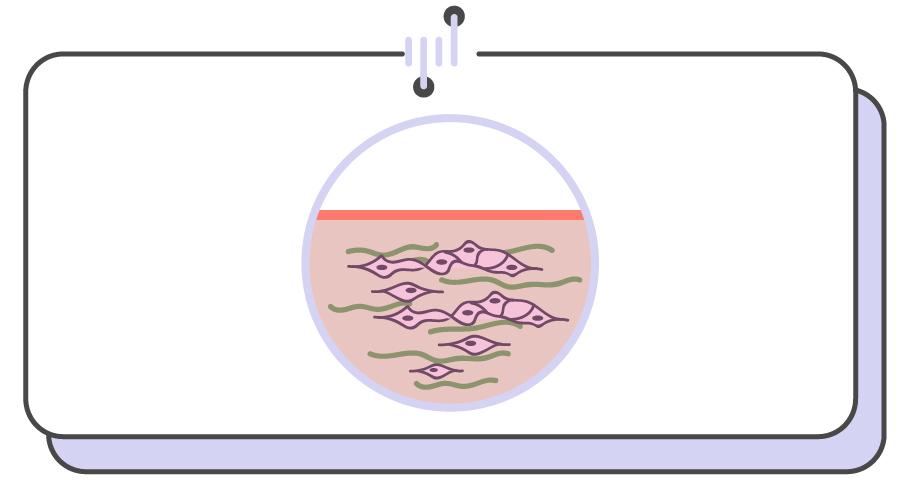手把手教你正确挤痘不留坑,挤痘挤了个坑