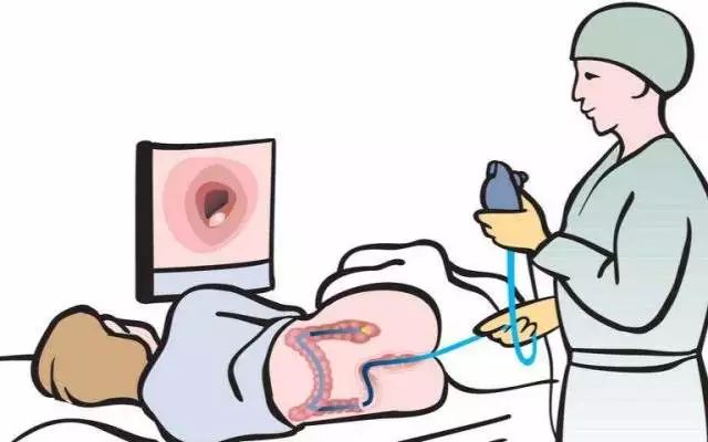 内镜诊疗,内镜小肠手术