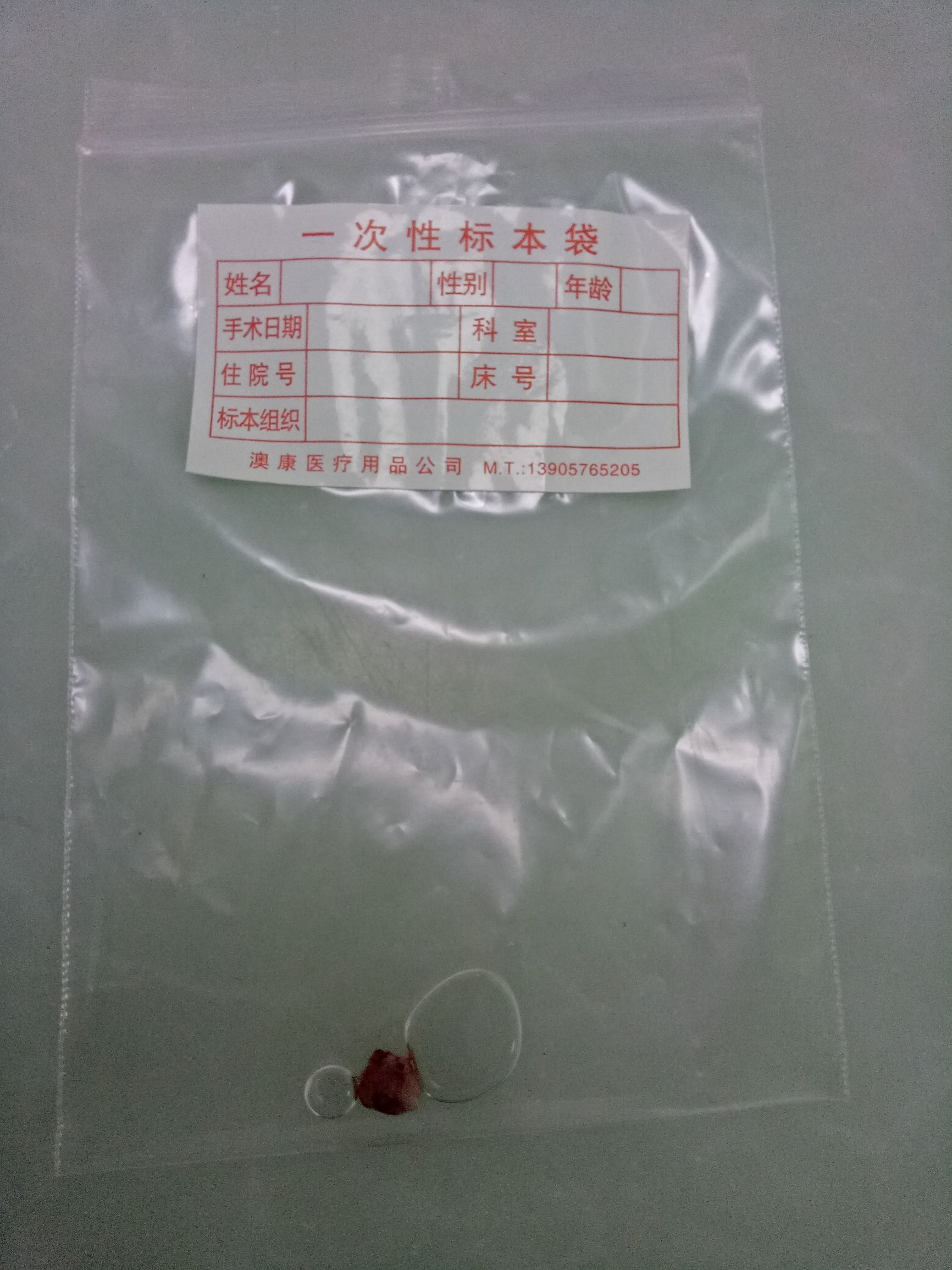 肩上的痣有危险吗,脖子后面有痣会压财吗