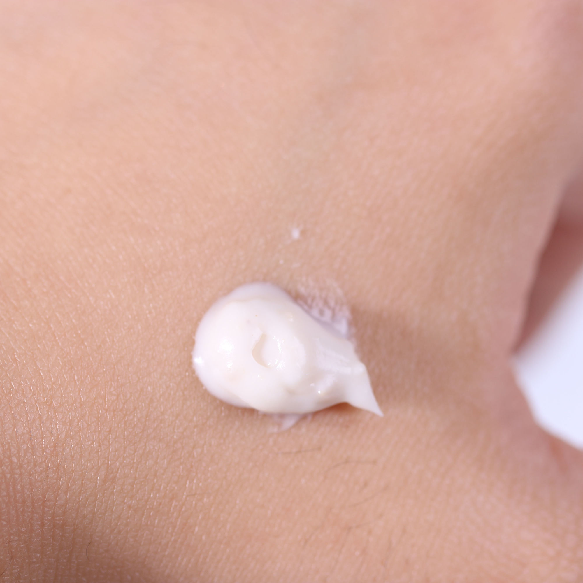 爆痘急救小妙招,今天突然爆痘怎么拯救