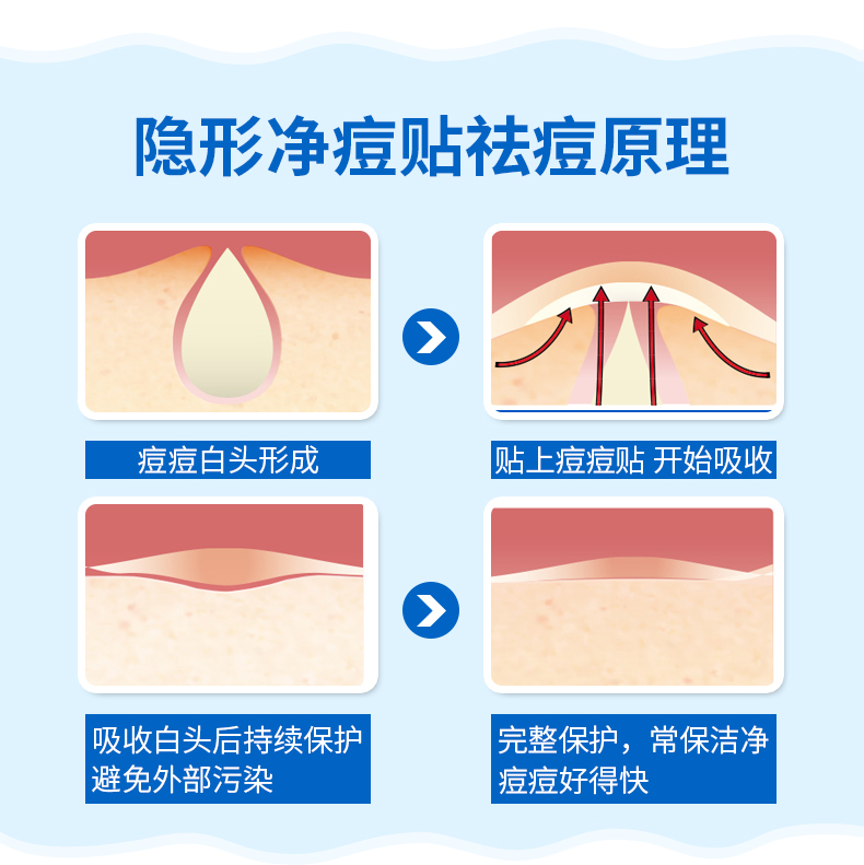 爆痘急救小妙招,今天突然爆痘怎么拯救
