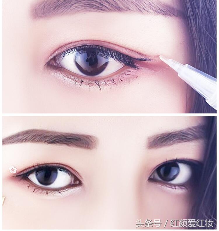 想要拥有双眼皮除了割还能做什么,真正有用的双眼皮神器