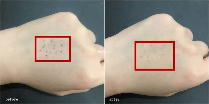 测评｜资生堂完美意境粉底霜（内含100元内资生堂好物推荐）