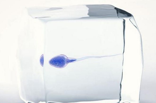 男性精子所有知识,如何判断精子死精