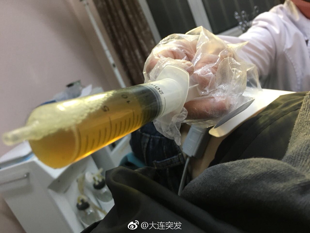 做一次妇检需要多少钱,做个妇科检查花了两千多