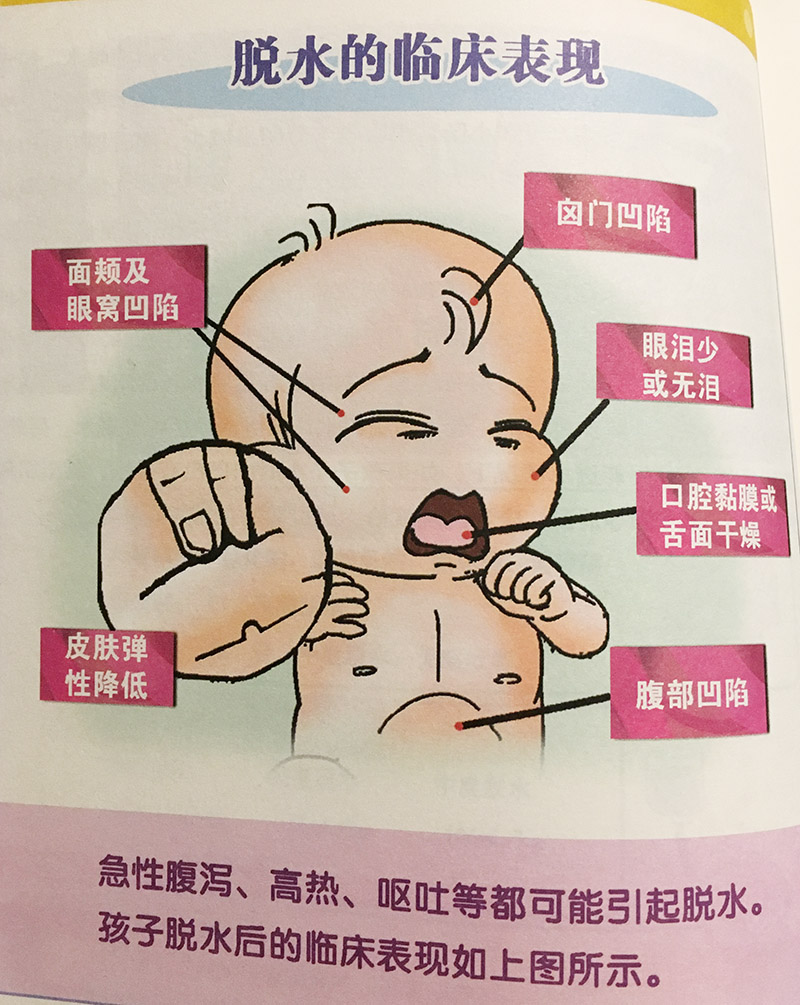 婴儿病毒感染呕吐腹泻,宝宝病毒感染呕吐腹泻