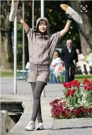 警惕静脉曲张可能掩盖严重血管病,警惕大隐静脉曲张