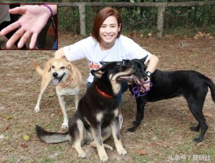 注射除皱案例,了解如何注射除皱