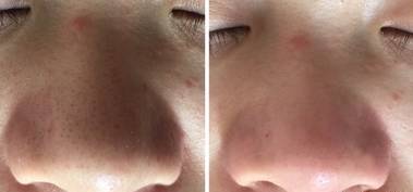 女朋友拒绝和我接吻,老婆拒绝接吻的原因