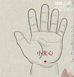 孩子话多关注力不集中是多动症,小孩子关注力不集中中医怎么解决