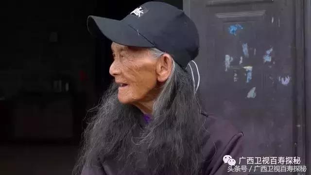 戴帽子导致的秃头会恢复吗,戴帽子秃头几率大