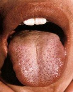 乙肝大三阳抗病毒治疗费用,我的乙肝小三阳自愈了