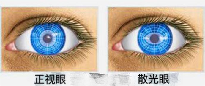 弱视专家王大夫,王大夫小儿微针疗法视频