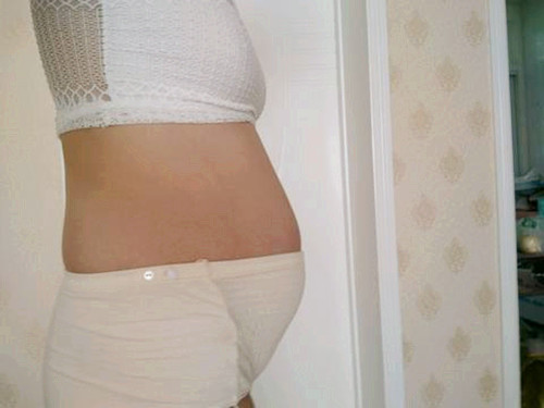 16天宝宝吐奶有血丝,100天宝宝吐奶是鲜红色是怎么回事