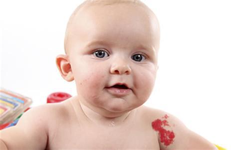 女孩子后背有胎记意义是什么,胎记的意义