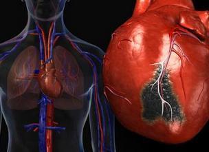 心脏扩大了现在又不大了,心脏增大不管它会怎样