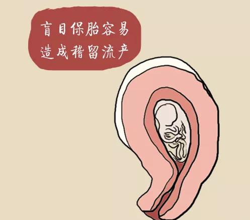 吃黄体酮保胎失败需要住院吗,承担宫外孕和保胎失败风险