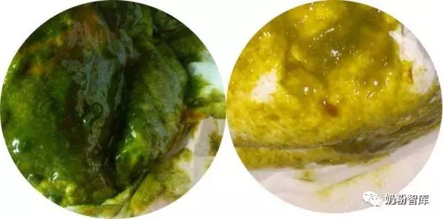 宝宝拉绿便最常见的10种原因,宝宝绿便11种改善方式