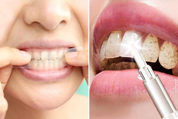 牙齿特别黄想什么办法能让它白,牙齿很黄怎么让它变白啊