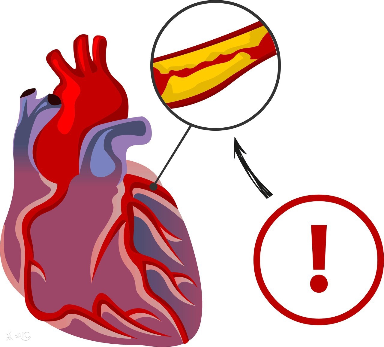 杏仁降胆固醇的正确方法,大蒜降胆固醇最快的方法