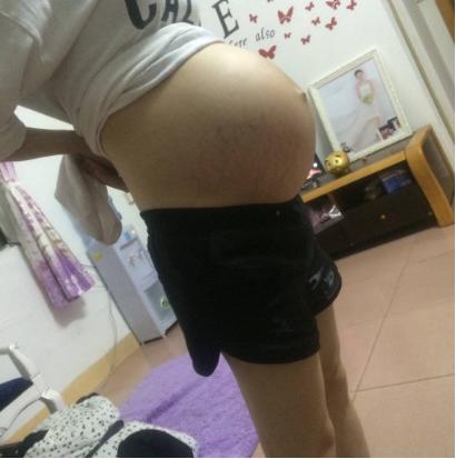 孕妇被熊孩子撞流产,孕妇被熊孩子撞到了