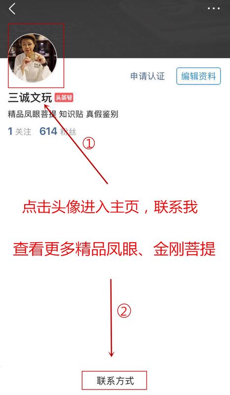 好好的眼睛突然睁不开了,好好的眼睛忽然之间模糊看不清楚