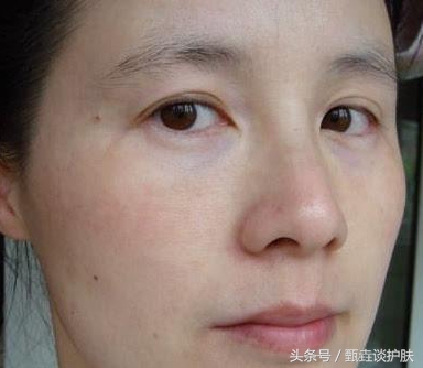 肤色黑黄不均匀怎么办,身上肤色不均匀暗黄怎么改善