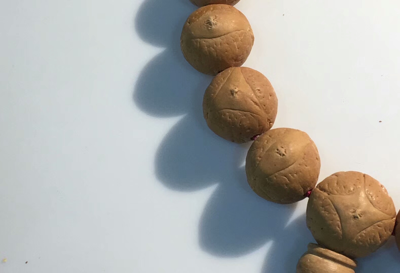 好好的眼睛突然睁不开了,好好的眼睛忽然之间模糊看不清楚