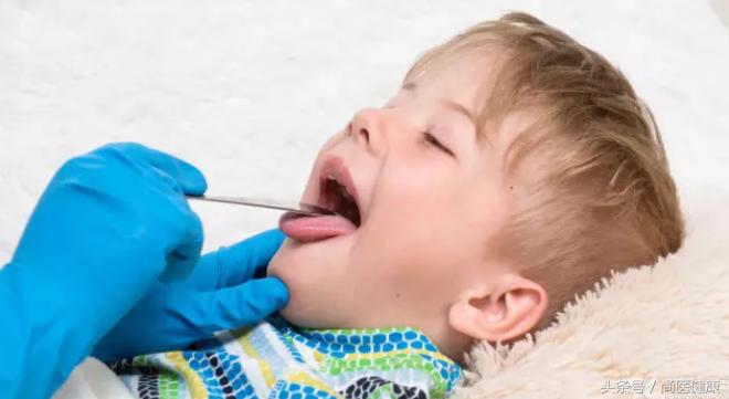 扁桃体反复发作有必要割掉吗,扁桃体一年发作一次需要切除么