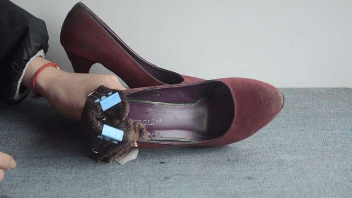 鞋子挤脚大拇指痛怎么办,鞋子挤脚不暖和