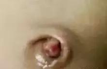 月嫂如何早发现新生儿脐部问题,月嫂给新生儿脐部消毒视频