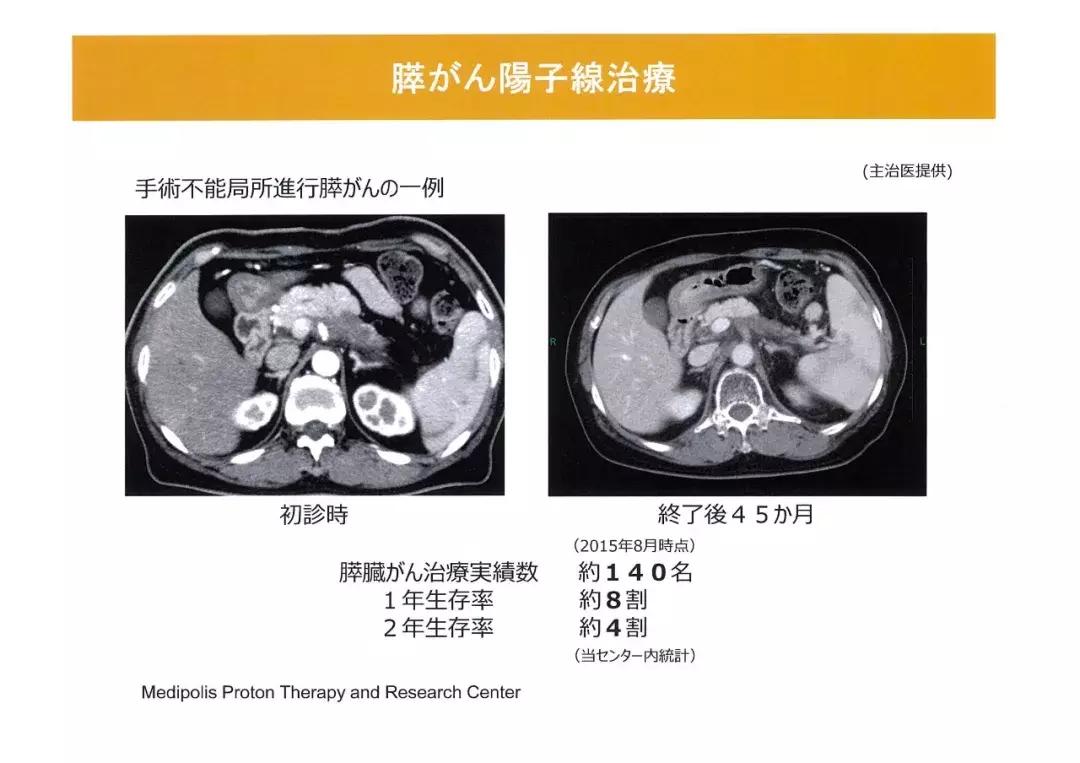 质子放疗中心安全距离,质子放疗介绍费