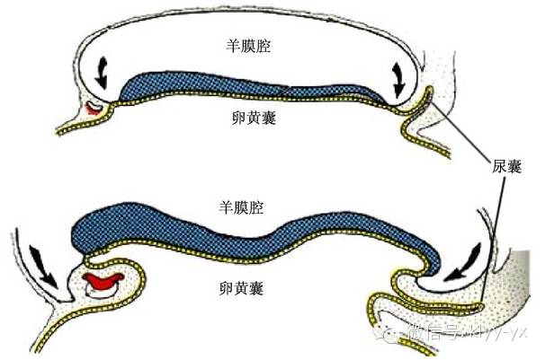 臀位提前破水怎么预防,临产破水怎么办