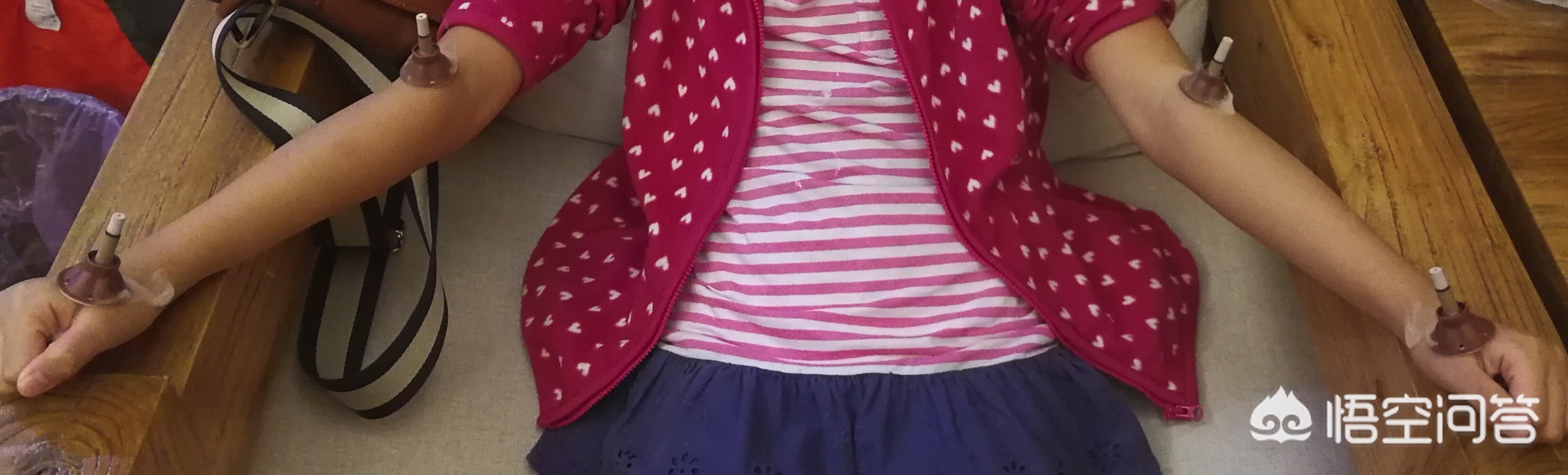 小朋友用药导致耳聋，我们应该思考什么！