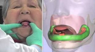 先天性缺牙原因及治疗,缺牙怎么办需要根管治疗吗