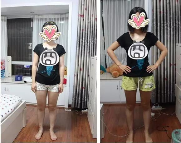 脂肪腿和水肿腿该怎么瘦,又是脂肪腿又是肌肉腿怎么瘦