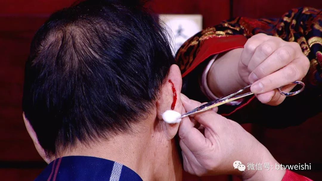 养生堂今日现场直播回放,养生堂程氏针灸视频