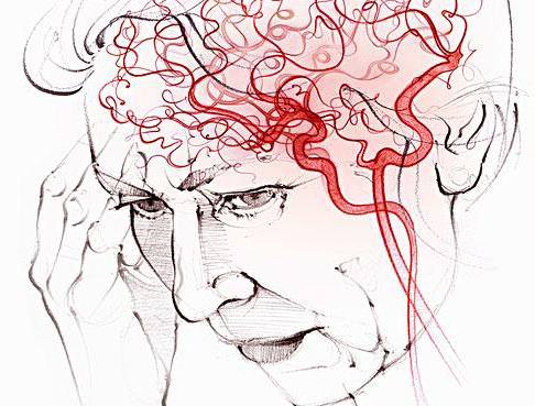 脑中风早期要花多少钱治好呢,脑中风一招救命