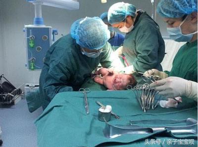 怀孕八个月忽然早产，胎儿“伸手”求救被拒，医生怒斥婆婆太狠心